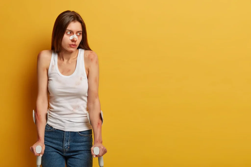 Leg Injuries from Car Accidents